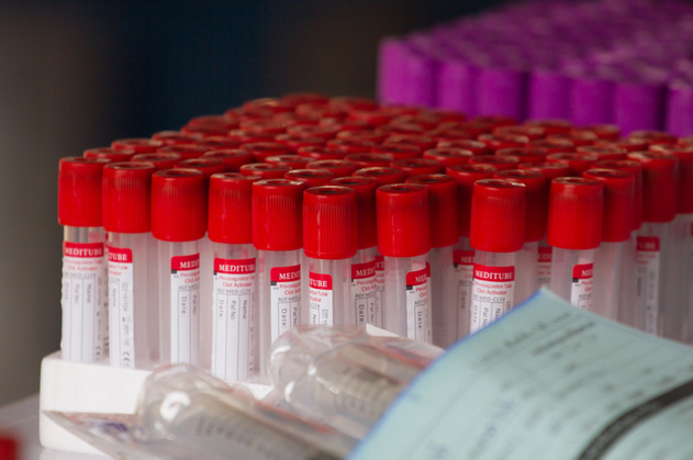 red and purple blood collection tubes