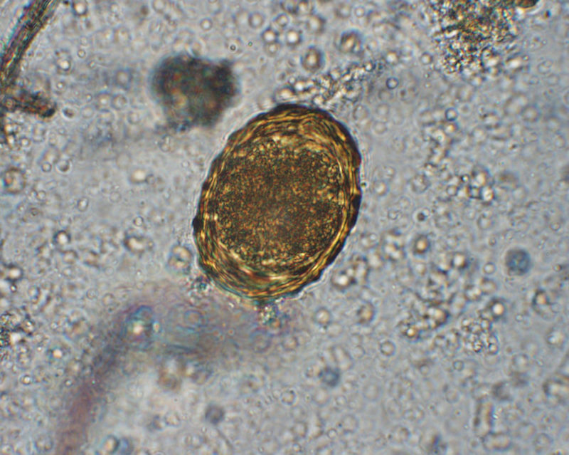microscopic view of an Ascaris summ egg. The egg is an amber oval. There are other small yellow dots in the image.