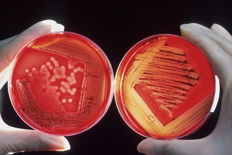 On the left side, a gloved hand hold a red Petri dish with white dots indicating bacteria growth. On the right side, a gloved hand hold a red Petri dish with white lines indicating bacteria growth.